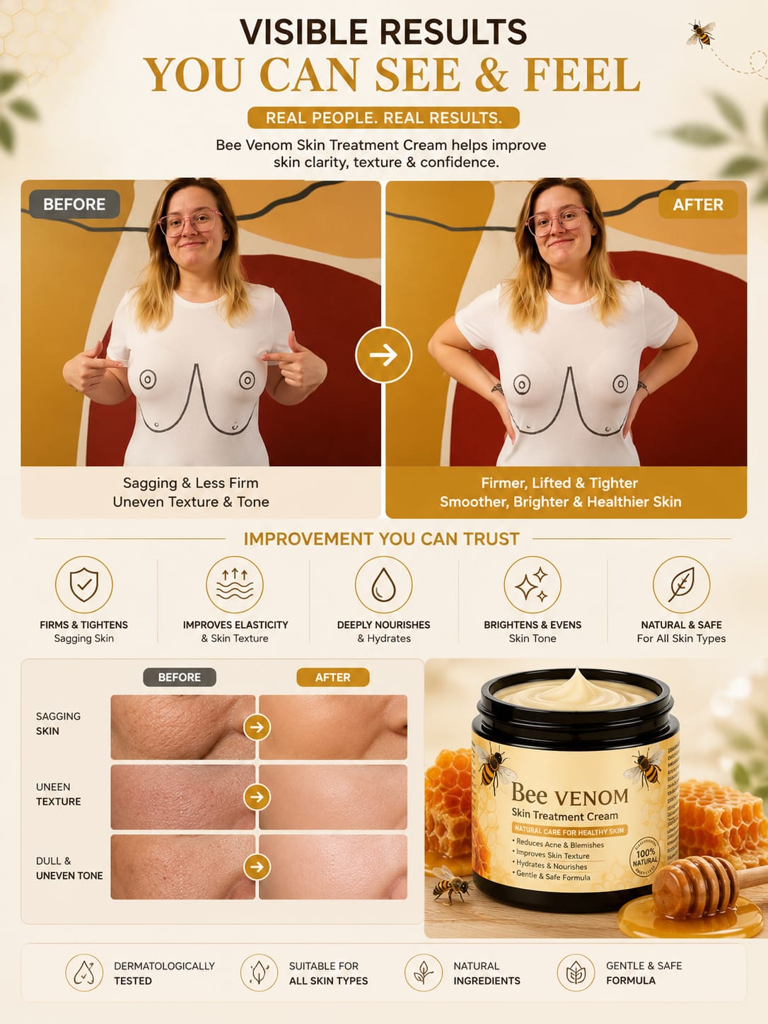 Premium Bee Venom Skin Treatment Cream for Acne, Dark Spots & Skin Repair | UAE